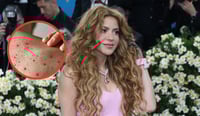 Alertan por posible exposición de sarampión en concierto de Shakira