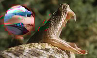 ¿Qué debes hacer si te muerde una serpiente? | Primeros auxilios