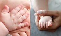 + Salud ¿Qué es el Síndrome de Rubinstein-Taybi?; conoce los síntomas