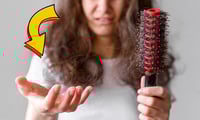 + Salud Los 5 mejores tratamientos para la caída del cabello, según Harvard | Precios