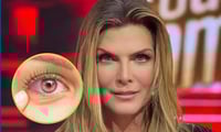 Imagen ¿Qué es un infarto ocular?; la afección que sufrió Montserrat Oliver