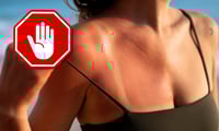 Por qué broncearse es muy peligroso para la salud de la piel