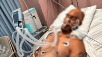 Agresiones Presentarán al luchador 'Baby Rap' ante el juez por golpiza que dejó a vecino en coma