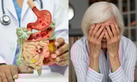Quienes padecen trastornos intestinales tienen el doble de probabilidad de tener Alzhéimer