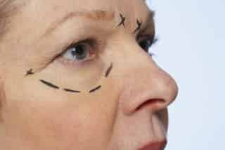 Aún no superan al Botox