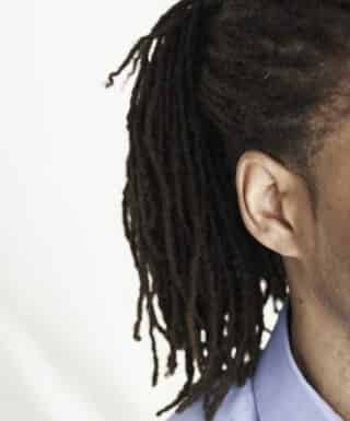 Rastas causan la caída permanente del pelo