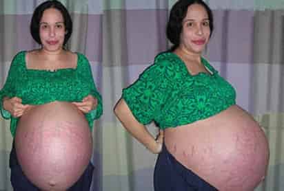 Suleman afirmó que tras siete años tratando de quedar embarazada acudió a la clínica de fertilización in vitro, donde se sometió a un programa de fertilidad con éxito. (Foto Especial)