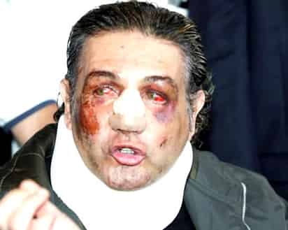 Trasladan al comunicador Fabián Lavalle a hospital, después de que lo encontraran golpeado y tirado en la calle.