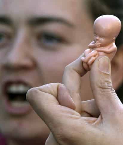 Desarrollo. Las conexiones nerviosas del cerebro no están lo suficientemente desarrolladas para sentir dolor antes de las 24 semanas. ARCHIVO