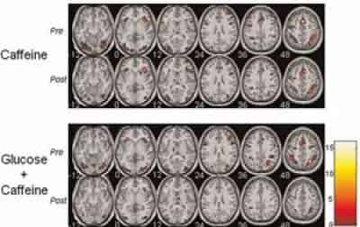 Un estudio demostró que el cerebro puede ser más eficiente bajo los efectos de la cafeína y la glucosa tomadas simultáneamente.