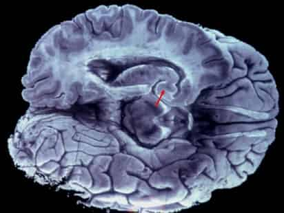 El estudio analiza áreas del cerebro que activan los mecanismos de recompensa cuando algo nos gusta. ARCHIVO