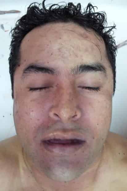 Las autoridades mexicanas confirmaron hoy la muerte de 'El Lazca'.