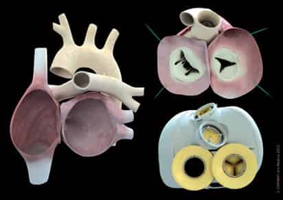 La sociedad, dedicada al desarrollo de prótesis médicas, fabricó a partir de tejidos biológicos un corazón totalmente artificial capaz de actuar de forma totalmente autónoma una vez trasplantado al paciente, una solución que podría resolver la escasez de donantes naturales. (EFE)