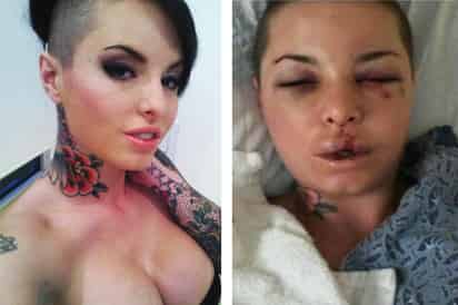 Christy fue golpeada brutalmente por su expareja. (INTERNET)