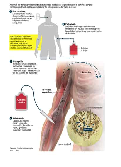 La espera de una médula ósea