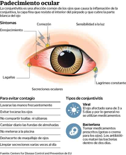 La conjuntivitis, efectos y prevención.  (EL UNIVERSAL)