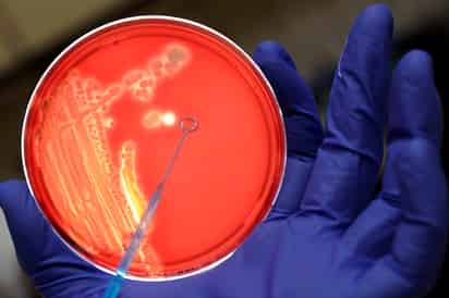 Se confirma que a pesar de la abrumadora diversidad de comunidades bacterianas del suelo relativamente pocas especies son verdaderamente abundantes. (ARCHIVO)