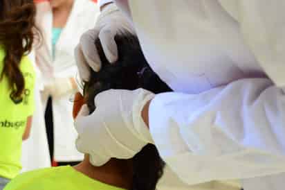 Se trata de un método de criogenización consistente en un casco con fomi y un cepillo que aplican pequeñas dosis de nitrógeno. (ARCHIVO)
