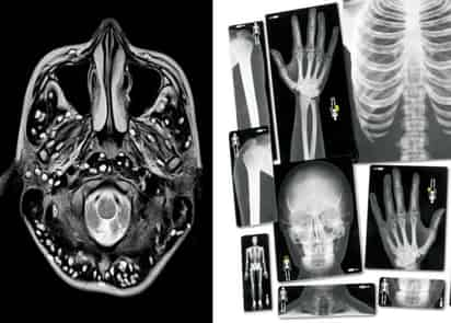 Las tenias estaban en su cerebro, pecho y pulmones. (INTERNET)