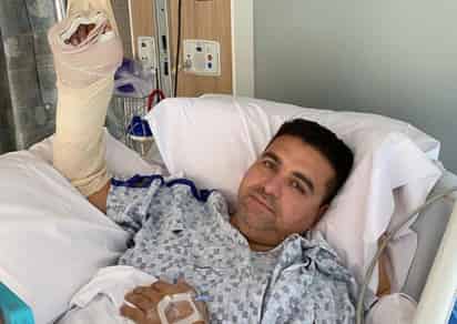La mano de Valastro quedó atrapada en el mecanismo de la máquina de bolos que tiene en su mansión, cuando intentaba arreglarla el domingo (@buddyvalastro)