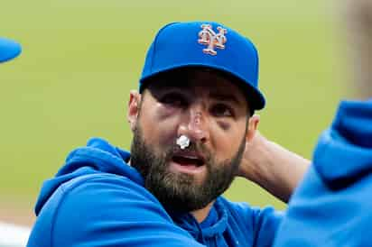 Kevin Pillar sufrió varias fracturas nasales tras recibir el lunes un pelotazo directo a la cara en el duelo ante Bravos. (AP)