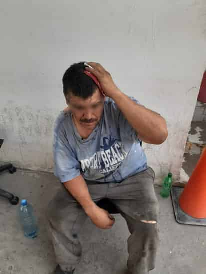 El trabajador de una vulkanizadora llegó a la Policía Municipal de Lerdo con una herida en la cabeza. (EL SIGLO DE TORREÓN)