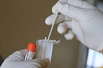 Descubierta a mediados de 2020, la variante conocida como Lambda del COVID-19 ya se encuentra en 40 países, según la Organización Mundial de la Salud (OMS).