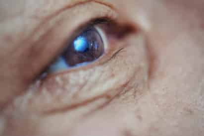 Una anciana británica de 88 años que había perdido la visión en el ojo izquierdo se ha convertido en la primera paciente en el Reino Unido que detecta señales en ese ojo usando un nuevo y revolucionario chip biónico. (ESPECIAL)