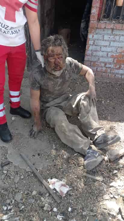 Las autoridades dijeron que el indigente estaba en estado de ebriedad y se quedó dormido en la vía pública.