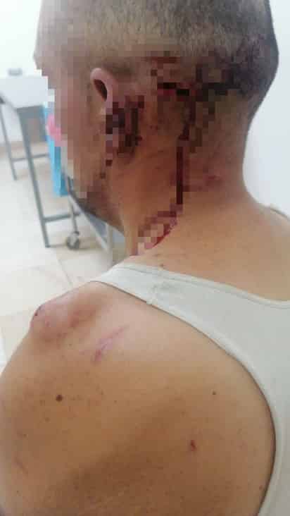 El hombre fue trasladado al Hospital General con múltiples lesiones en el área de la cabeza y golpes en el cuerpo.
