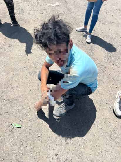 El joven de 20 años de edad resultó con múltiples lesiones.