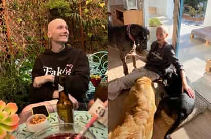 Muere a los 20 años el 'influencer' Charlie tras padecer cáncer