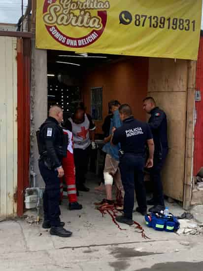 El sujeto recibió un disparo en una pierna, asegura que lo agredieron cuando hacía sus necesidades en un terreno baldío.