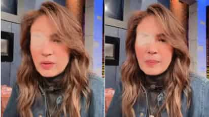 Yolanda Andrade reaparece en redes con un parche en el ojo