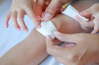 El buen cuidado previene infecciones y minimiza las cicatrices.