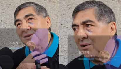 Carlos Bonavides preocupa al aparecer con moretones en el rostro