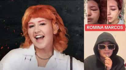 Herpes zóster, la enfermedad que está afectando la salud de Romina Marcos