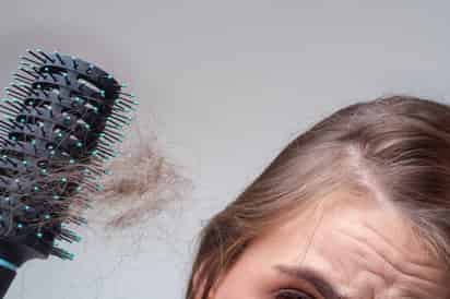 Alopecia, afecta a hombres y mujeres