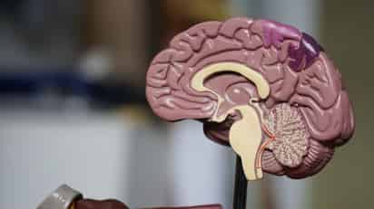 El grupo sanguíneo con más probabilidades de padecer Alzheimer