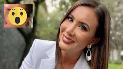 ¿Qué le pasó? Mariazel provoca la alarma en sus seguidores tras aparecer con el ojo morado