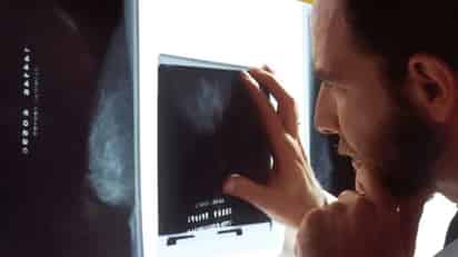En los resultados del ensayo también se observó que el tiempo medio que tarda el tumor en volver a crecer. (Foto: National Cancer Institute)