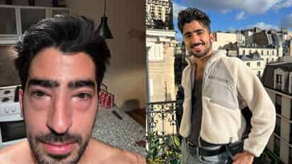 ¿Qué le pasó? Influencer Jezzini preocupa a sus fans al aparecer con los ojos hinchados