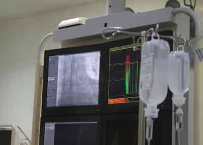 Este año han fallecido 80 personas por infarto al miocardio en IMSS Durango