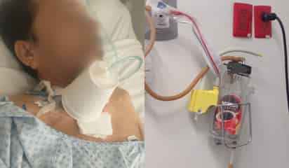 Atienden a pacientes con frascos para café y vasos de unicel en Hospital Nuevo de Gómez Palacio