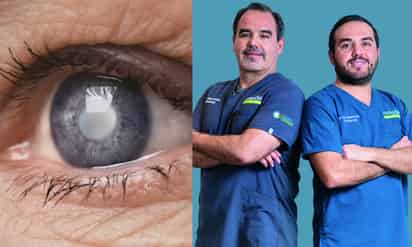 Cataratas: diagnóstico, cirugía y recuperación