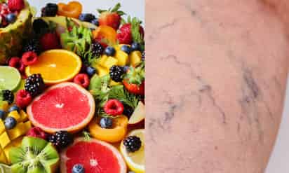 Come esta fruta para combatir las varices