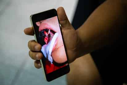 Extracción de un diente, casi le cuesta la vida a un menor de 14 años; padres buscan justicia