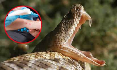 ¿Qué debes hacer si te muerde una serpiente? | Primeros auxilios