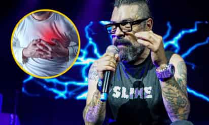 ¿Qué es un preinfarto, condición que 'sufrió' vocalista Panteón Rocco?
