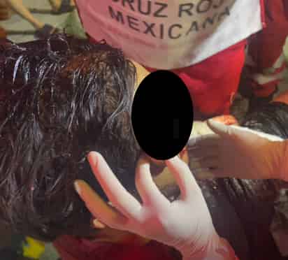 Grave, hombre lesionado en pelea entre vecinos de la colonia La Noria de Torreón